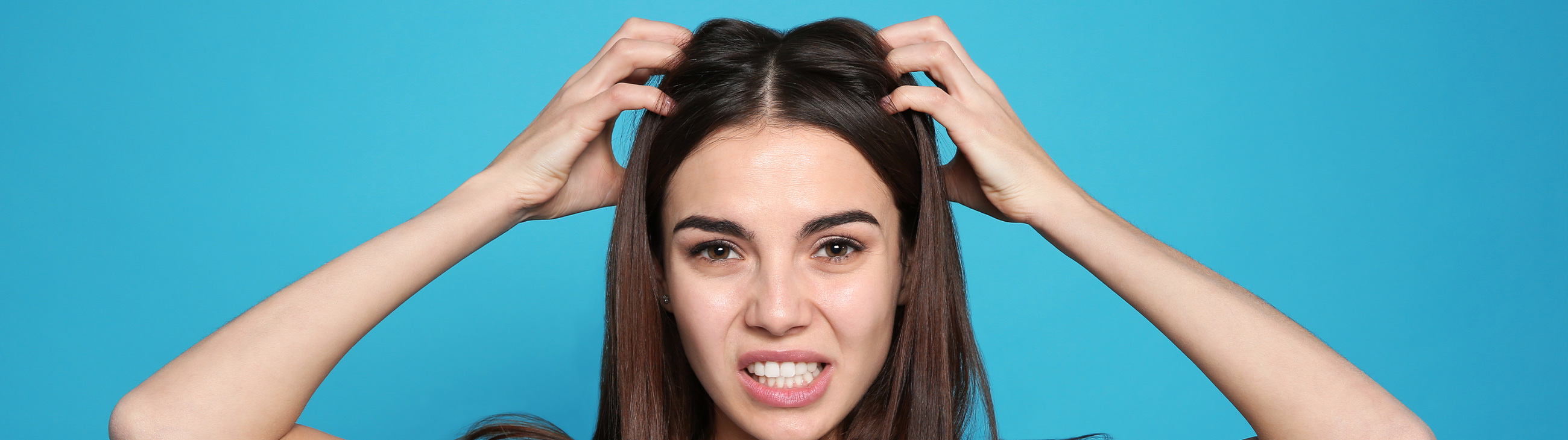 La caspa, la dermatitis seborreica y la psoriasis capilar suelen  confundirse entre sí, ya que todas producen escamas en el cuero cabelludo…