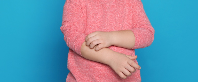 Do you have eczema or scabies? Understand the differences