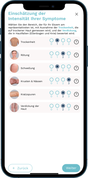 Beobachtete Symptomstärke