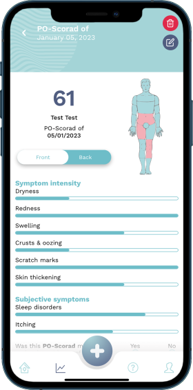 Surface area of skin affected