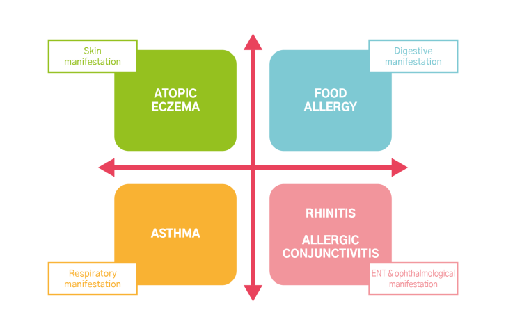 atopy diseases