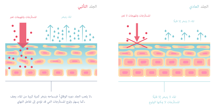 الحاجز الجلدي